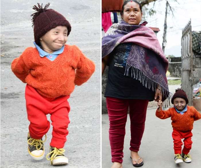 Самый маленький человек в мире скончался в 27 лет от пневмонии 18 97514752