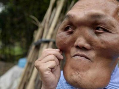 Найден мужчина с головой пришельца (фото) 20 Najden muzhchina s golovoj prisheltsa