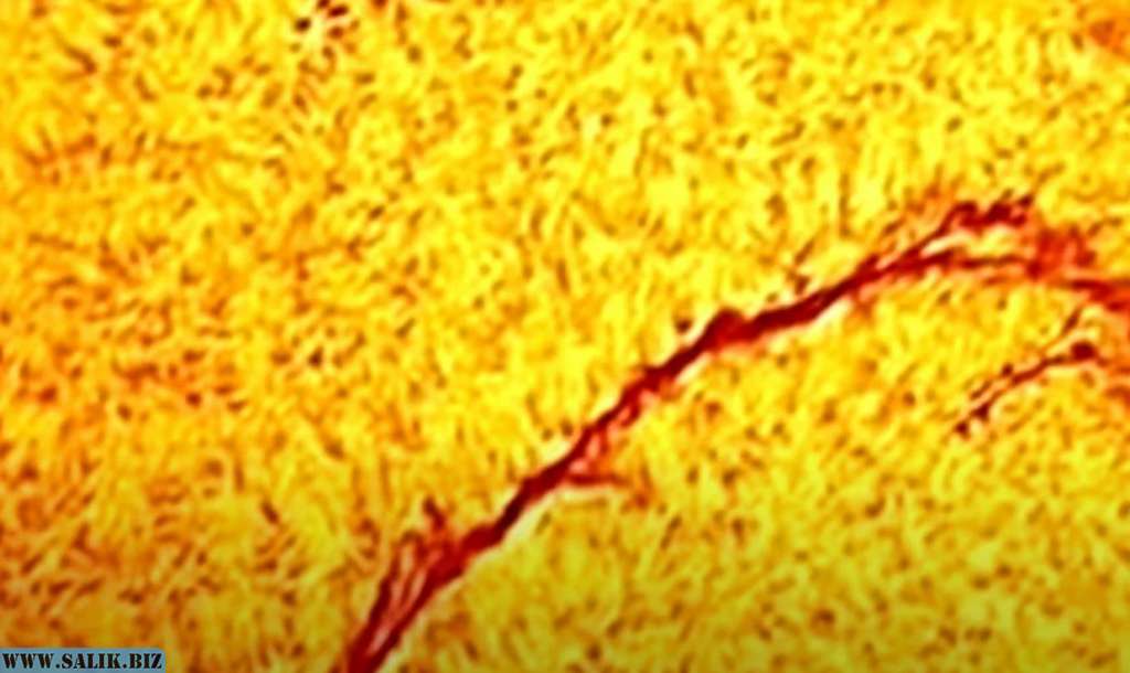 06769929ef6355afd1d43496d8cc3c4c 1