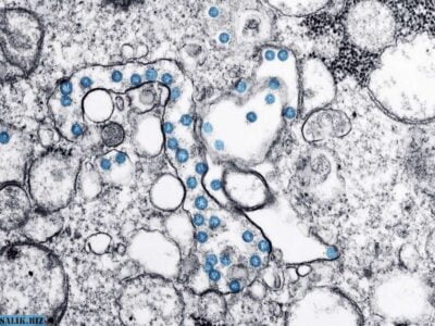 Коронавирус мог возникнуть в результате проведения экспериментов 23 a3fbe716fc1fbcfad4368a17927345fc 1