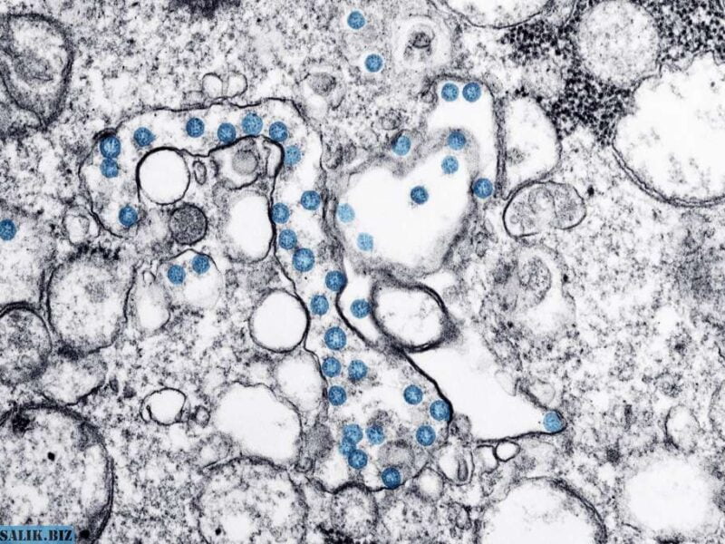 a3fbe716fc1fbcfad4368a17927345fc 1