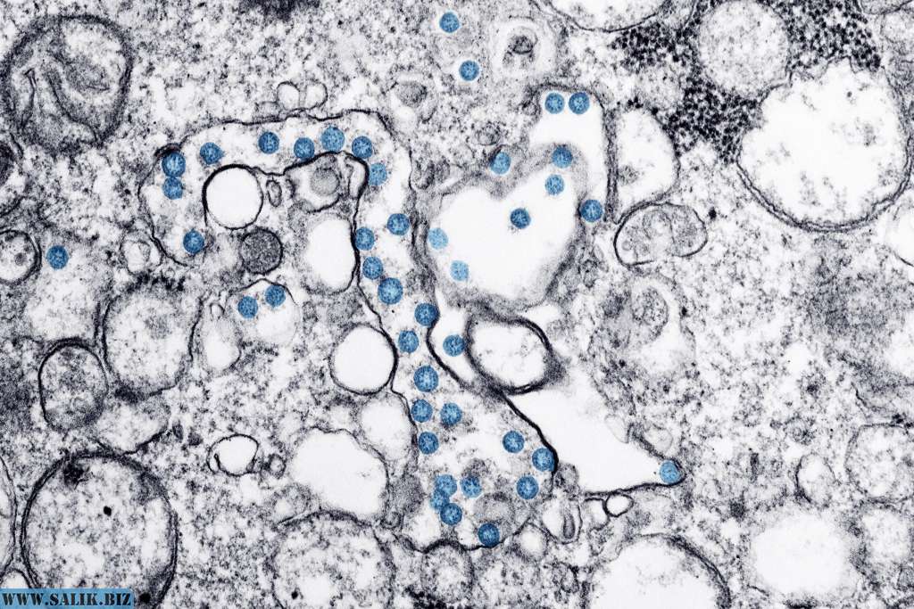 Коронавирус мог возникнуть в результате проведения экспериментов 18 a3fbe716fc1fbcfad4368a17927345fc 1