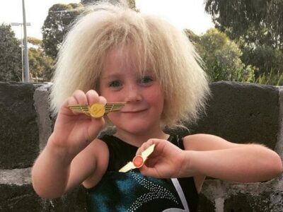 10-летняя австралийка с аномальной структурой волос прославилась в сети 28 esrpic 5fca52f4a8b5f1