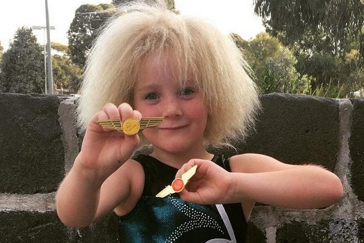 10-летняя австралийка с аномальной структурой волос прославилась в сети 18 esrpic 5fca52f4a8b5f1
