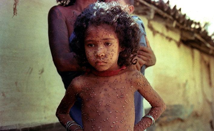 Миру удалось победить лишь один вирус — смертельную болезнь, бушевавшую тысячи лет 18 71842715