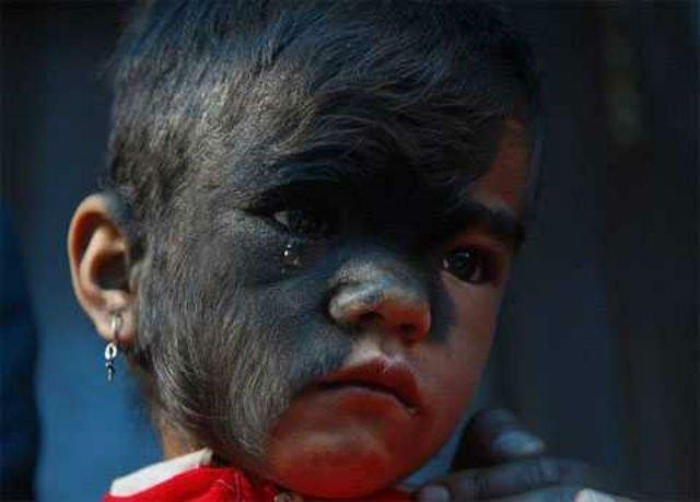 Devochku sochli vedmoj i izgnali vmeste s semej iz derevni