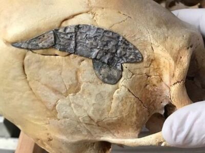 Удлиненный череп с имплантированным куском металла является доказательством передовой хирургии древних 20 11588401