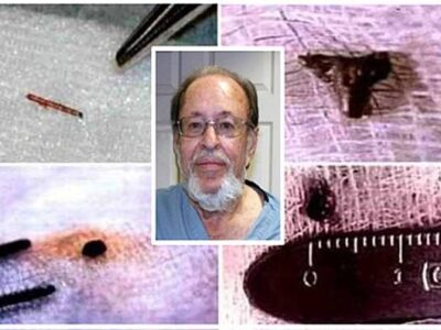 Что происходит с человеком после удаления инопланетного имплантата 24 43115287