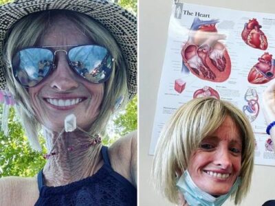 44-летняя жительница Огайо одна из редких долгожителей с прогерией 25 87136097