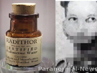 Человек, который пил радиоактивное лекарство, пока не отвалилась нижняя челюсть 22 02022331