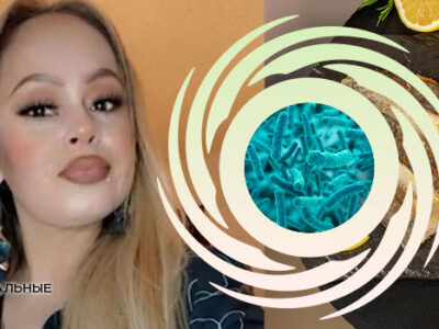 🐟 Женщина лишилась рук и ног после того, как съела рыбу, зараженную плотоядной бактерией 22 62409589