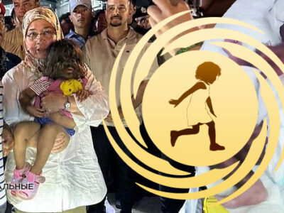 🧒 Девочку с «синдромом оборотня» правитель Малайзии назвал «Дитя Небес» 23 76418830 1