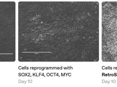 OpenAI: ИИ в борьбе со старением 23 7739