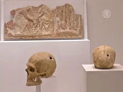 Drevnie greki sverlili cherepa i lechili travami